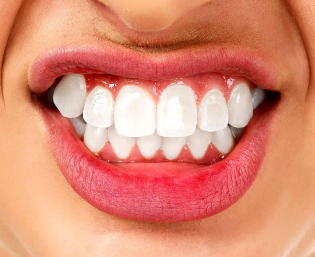Bruxism treatment Vancouver