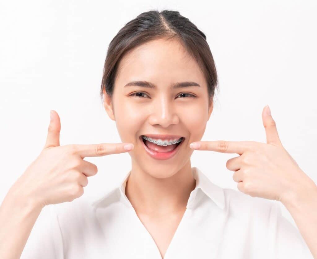 Orthodontic Treatment Phases