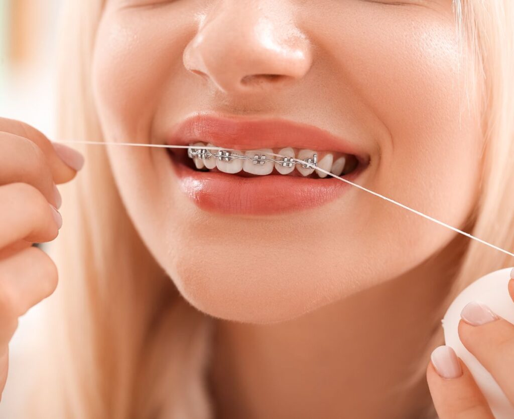 What is Orthodontics?