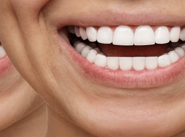 Latest Cosmetic Dentistry Trends in 2025
