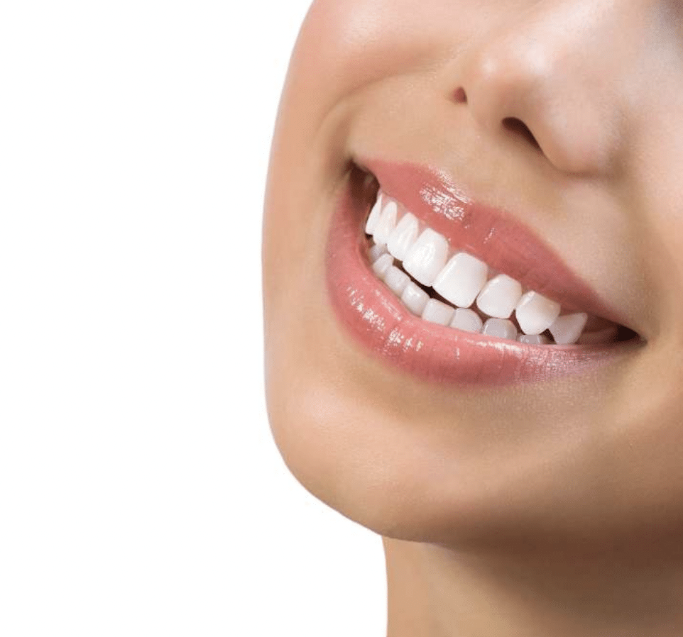 Veneer Maintenance