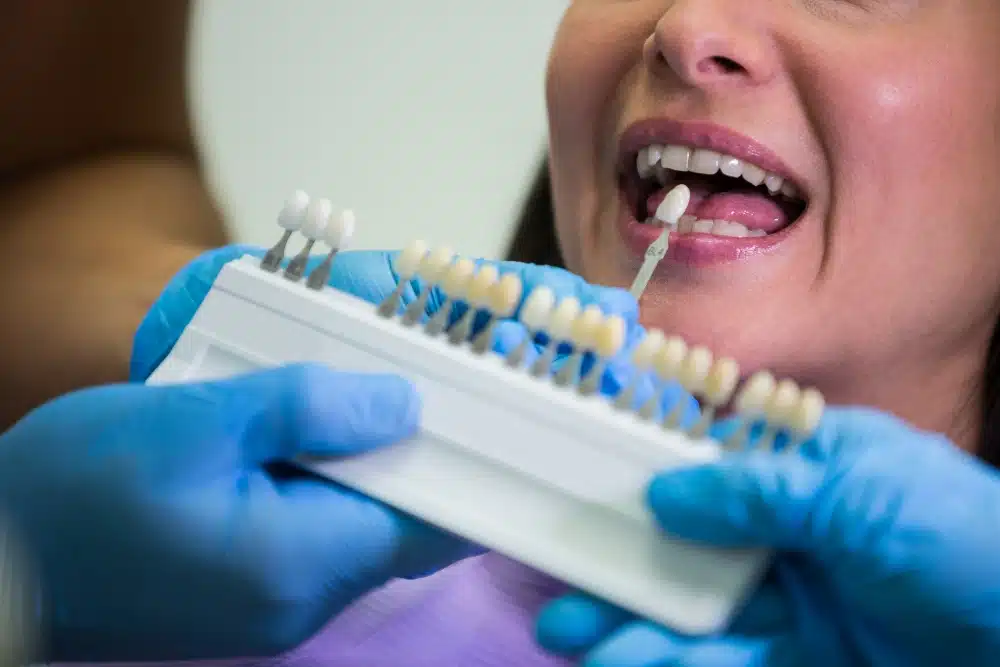 Woman examining dental veneer shade options with a dental professional, showcasing cosmetic dentistry services at Hastings Dental Center.