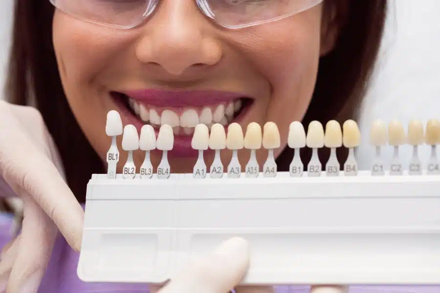 Smiling dental professional showcasing dental veneer color samples for cosmetic dentistry solutions at Hastings Dental Center.